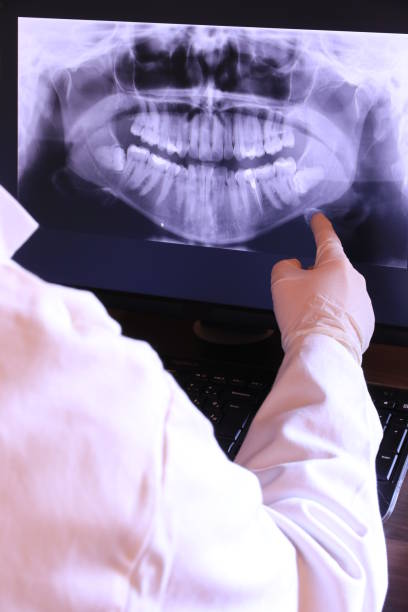 Best Broken or Chipped Tooth Repair in Moss Point, MS