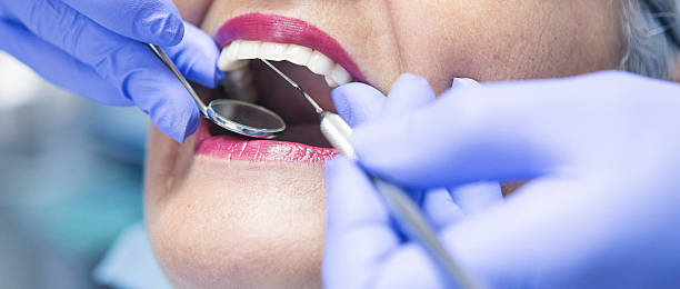 Best Emergency Wisdom Tooth Extraction in Moss Point, MS