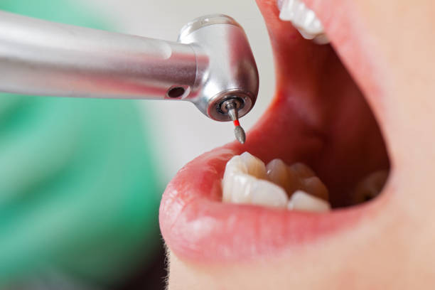Best Urgent Dental Care for Toothaches in Moss Point, MS